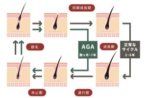 ヘアサイクルとAGAの関係